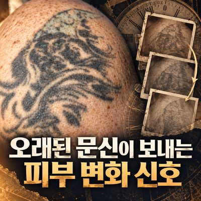 오래된 문신이 보내는 피부 변화 신호