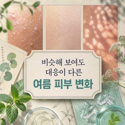 비슷해 보여도 대응이 다른 여름 피부 변화