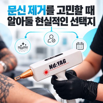 문신 제거를 고민할 때 알아둘 현실적인 선택지
